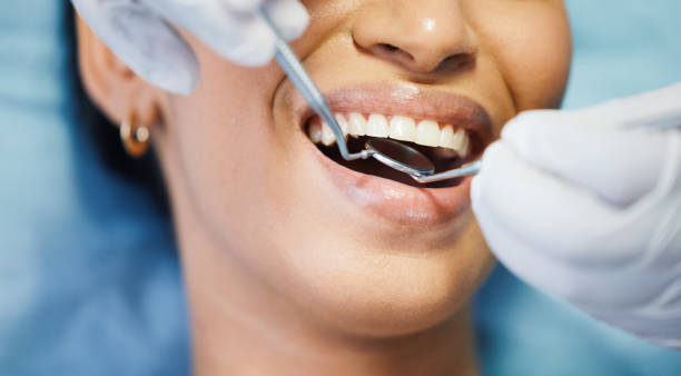 Best Emergency Tooth Extraction in Sunset, UT